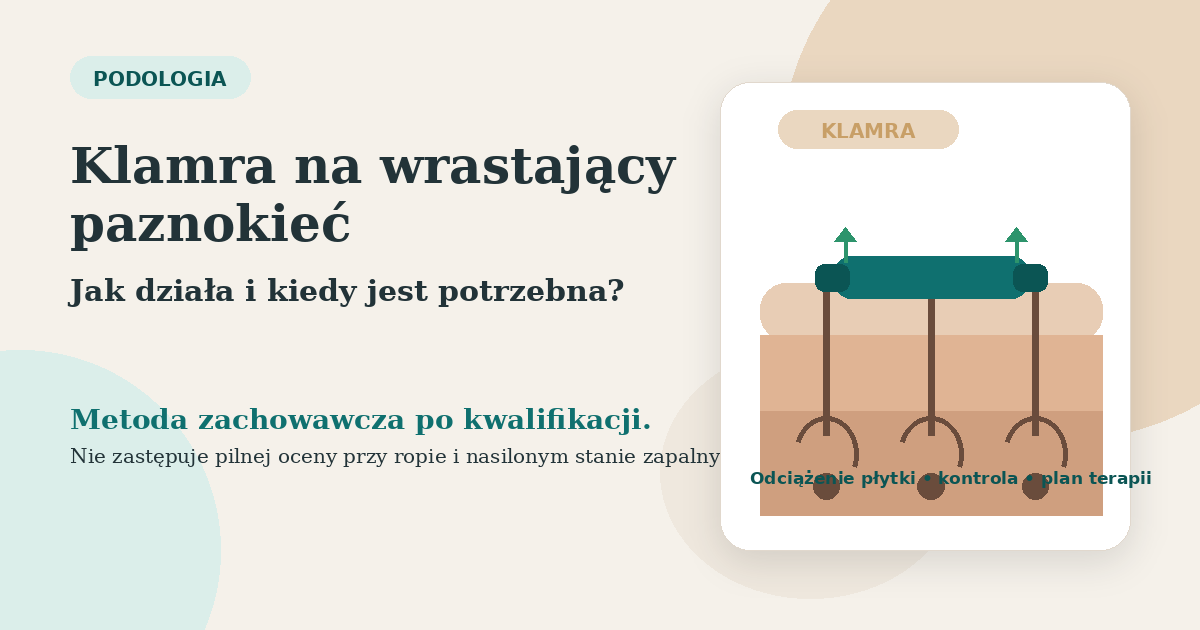 Objawy alarmowe przy wrastającym paznokciu i leczeniu klamrą: kiedy potrzebna jest pilna konsultacja