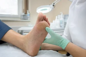 Odciski modzele konsultacja podologiczna