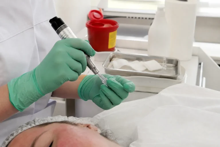 Przygotowanie sterylnego kartridża do Dermapenu w gabinecie kosmetycznym